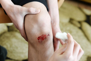 Professional vs Self-Treatment: The Benefits of Expert Wound Care Services